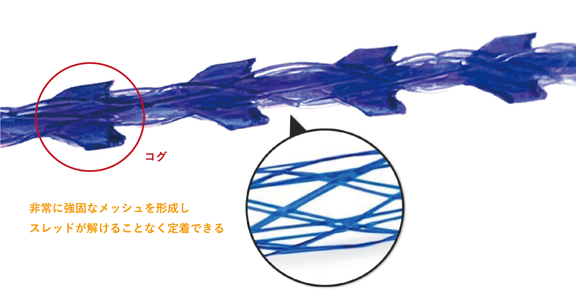 アルテミスリフト / 圧倒的な持続力と力強いリフトアップを可能に